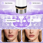 Microcurrent Facial Massager for Skin Tightening and Lifting