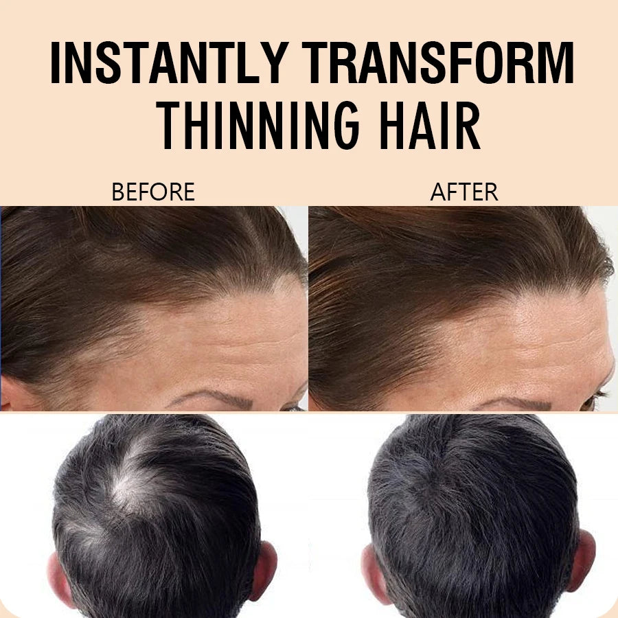 15g Hair Building Fibers for Thinning Hair and Bald Spots - 5