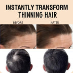 15g Hair Building Fibers for Thinning Hair and Bald Spots