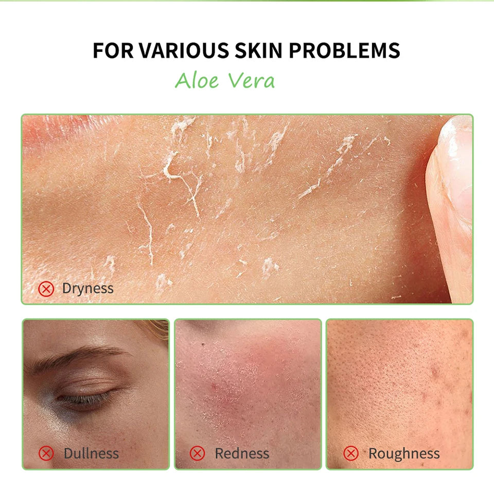 Soothing Aloe Vera Hydrating Face Gel
