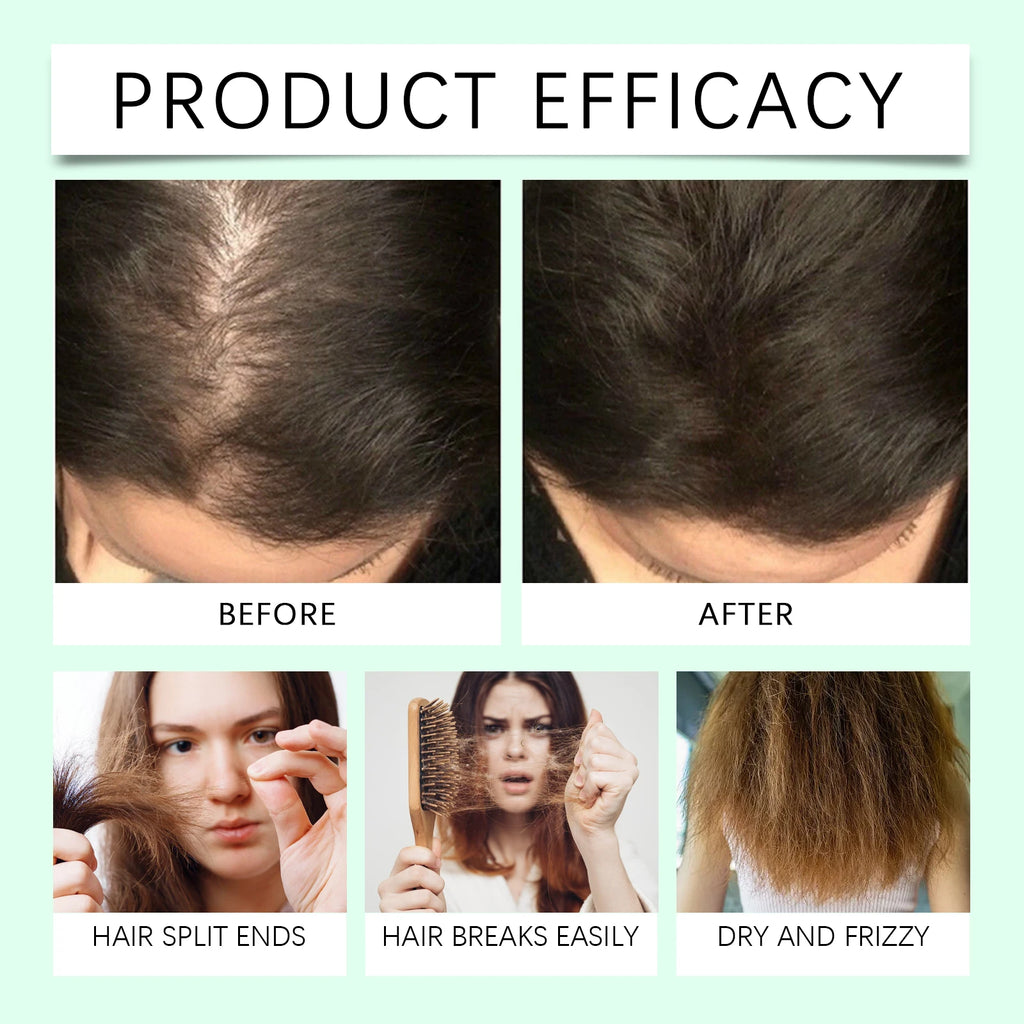 Rosemary Hair Growth Oil for Scalp and Thinning Hair