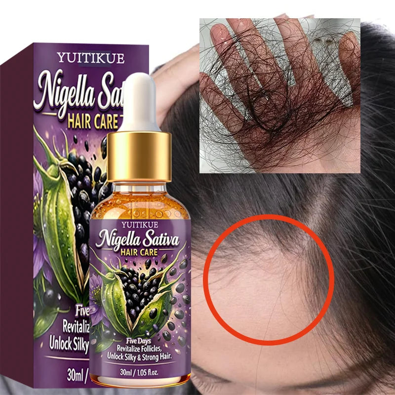 Nigella Sativa Hair Care Oil 30ml Follicle Revitalizing Treatment - 1