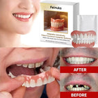 Custom Fit Cosmetic Denture Set for a Confident Smile