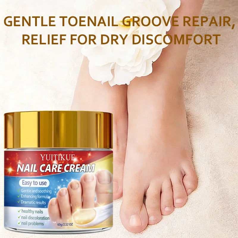 Yuitikue Nail Repair Cream 60g for Discolored and Damaged Nails