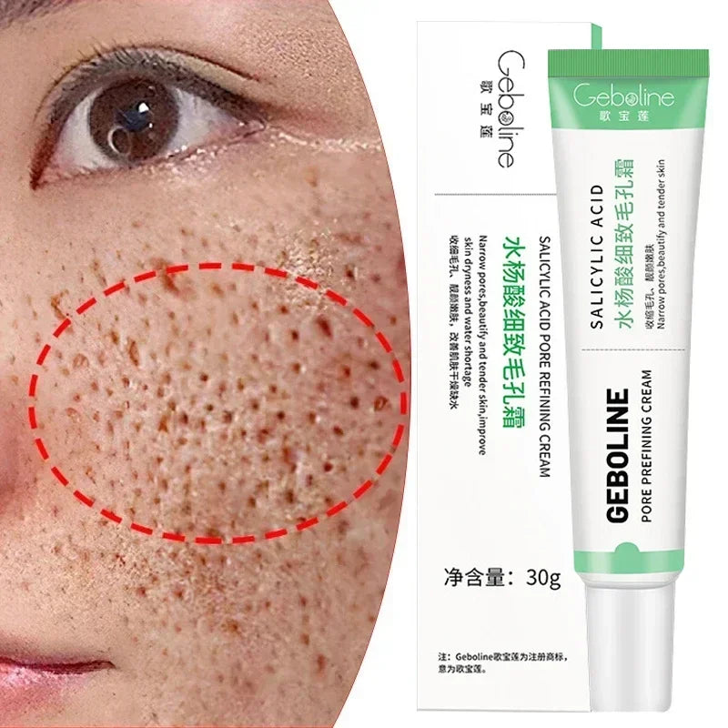 Salicylic Acid Pore Refining and Acne Repair Cream