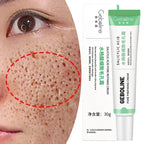 Salicylic Acid Pore Refining and Acne Repair Cream