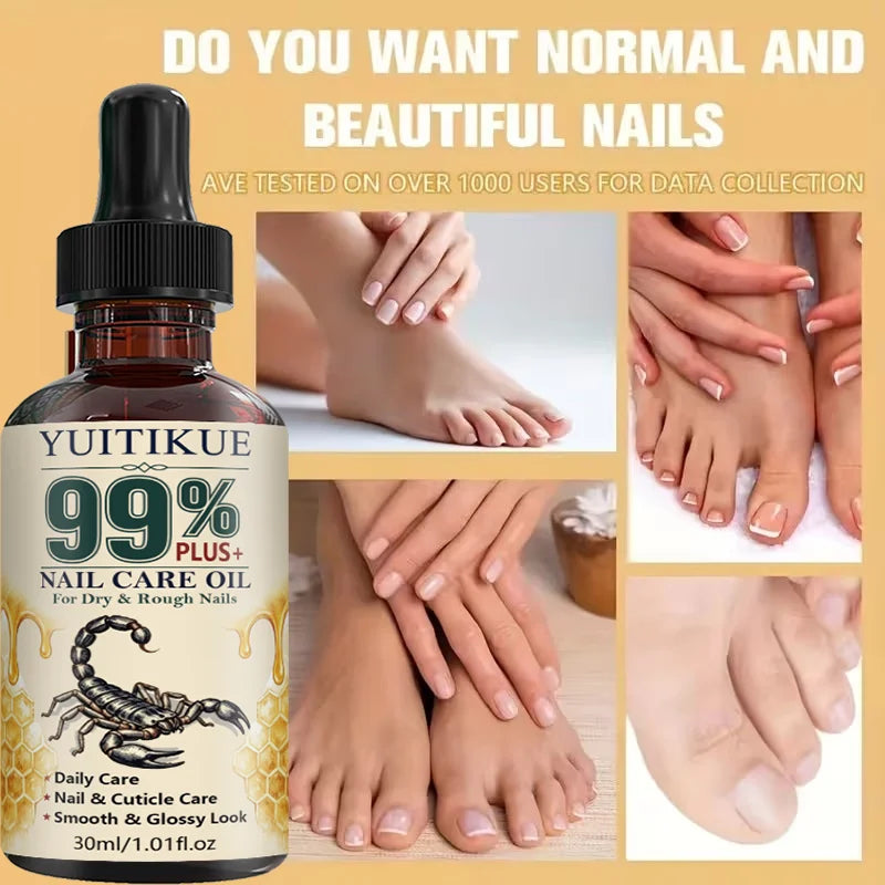 YUITIKUE Nail Care Oil Moisturizing Cuticle Treatment for Dry Nails - 1