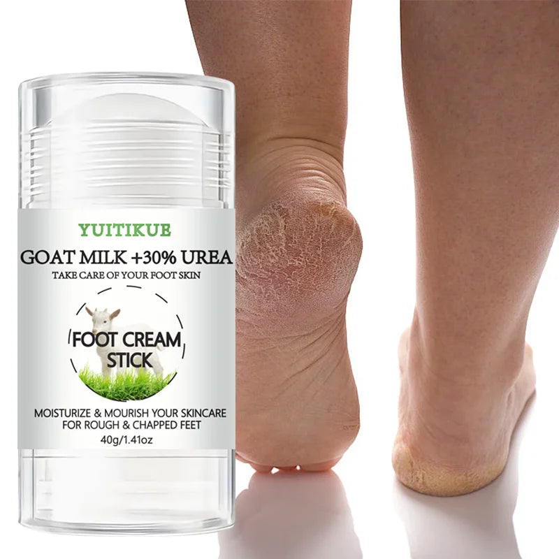 YUITIKUE 30% Urea Goat Milk Foot Cream Stick for Dry Cracked Heels 40g - 1