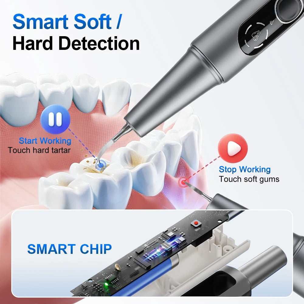 Visual Ultrasonic Tooth Cleaner with HD Camera for Tartar Removal - 11