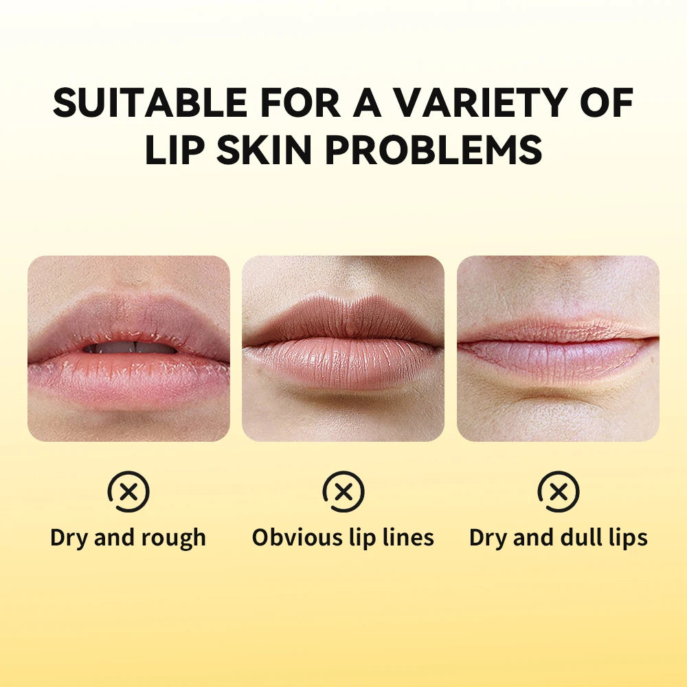 Propolis Hydrating Lip Gel for Dry and Chapped Lips - 5