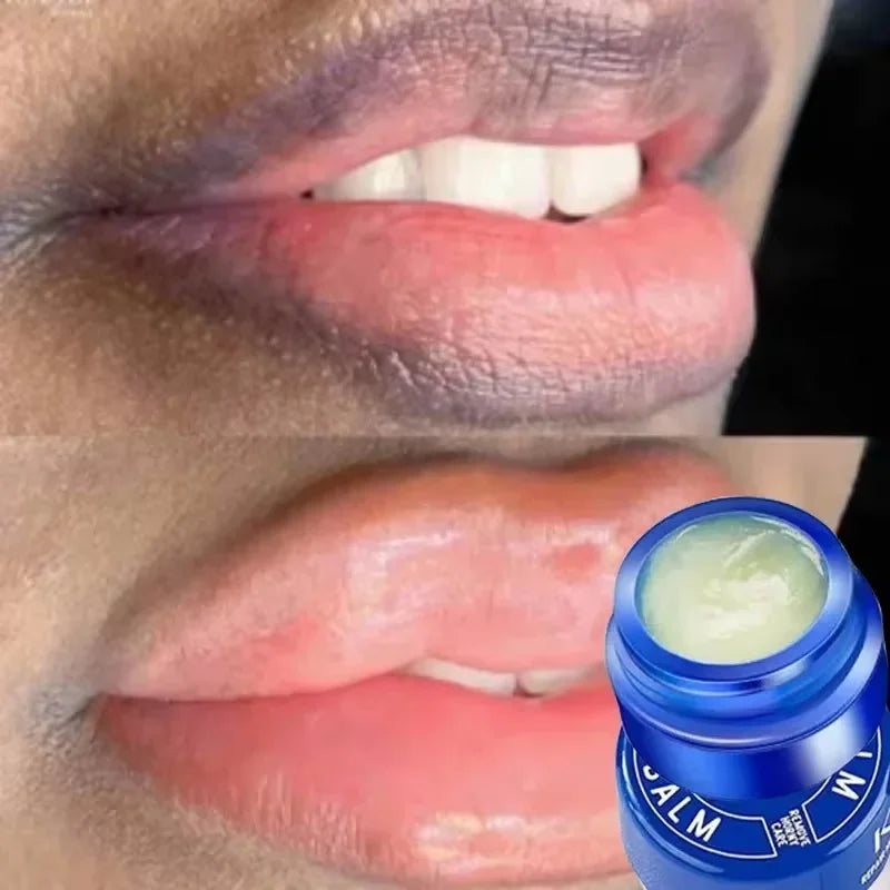 Brightening Lip Balm for Dark Melanin and Dry Lips