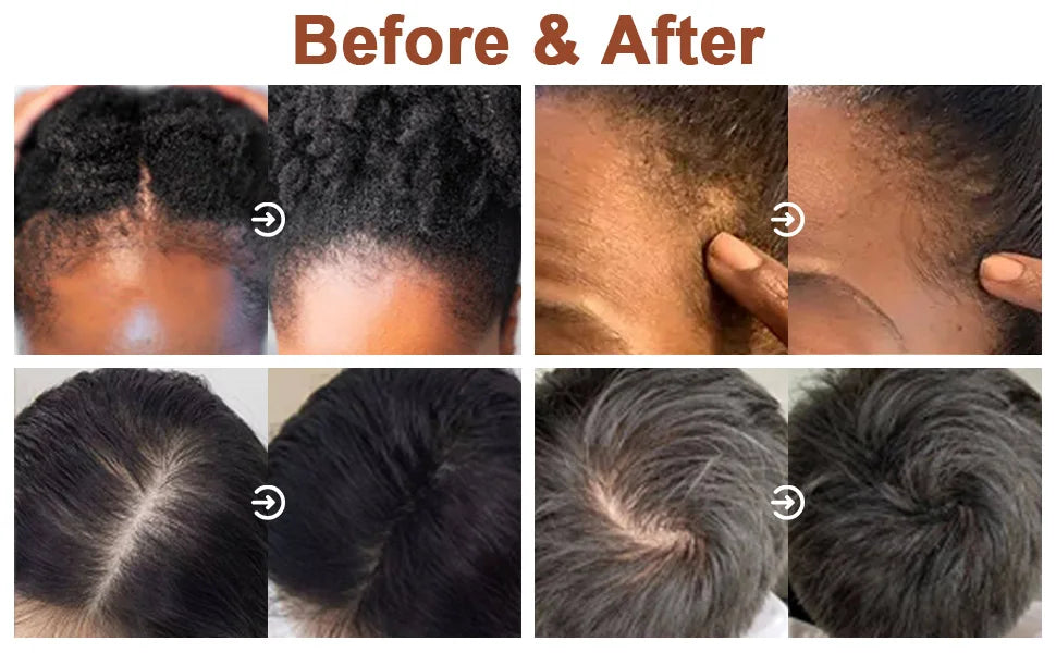 Lockmio Chebe and Batana Oil Hair Care Set for Healthy Nourished Hair