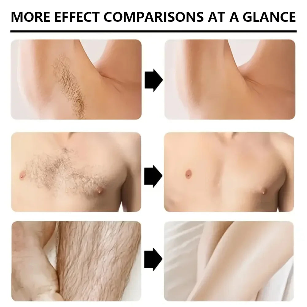 Mens Hair Removal Cream 100g Full Body Use - 6