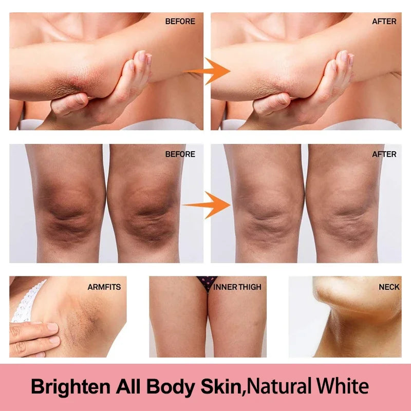 Vitamin C Skin Brightening Cream for Dark Spots and Underarms - 7