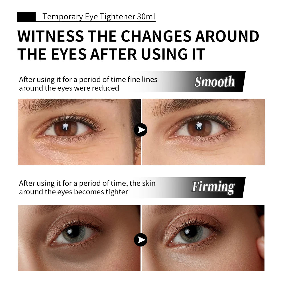 Temporary Anti-Aging Eye Tightening Cream for Wrinkles and Puffiness