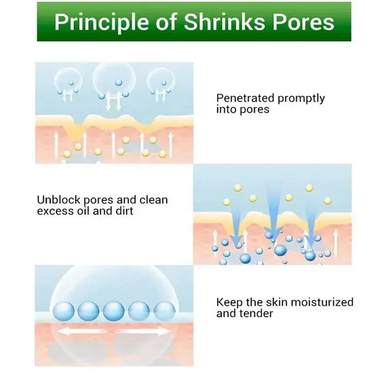 Salicylic Acid Pore Refining and Acne Repair Cream