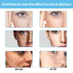Brightening Face Cream Dark Spot Corrector and Skin Whitening Treatment