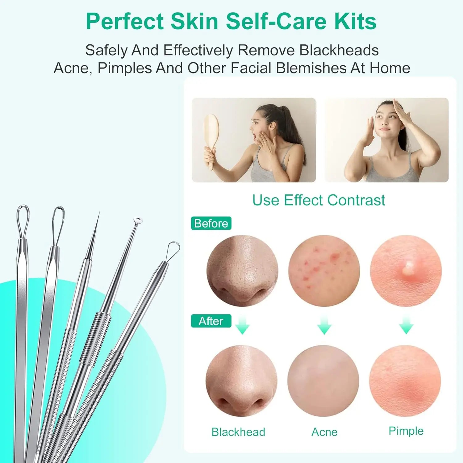 Professional Stainless Steel Blackhead and Pimple Extractor Tool Kit - 4