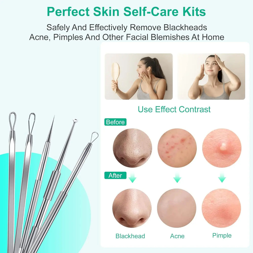 Professional Stainless Steel Blackhead and Pimple Extractor Tool Kit