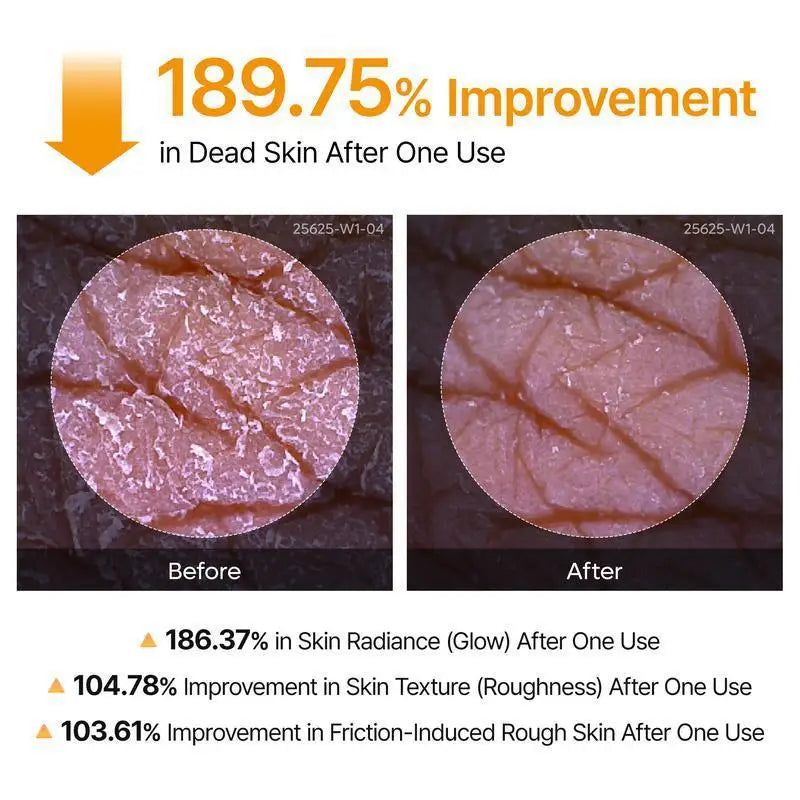 FLEXQW Kojic Acid Turmeric Exfoliating Body Scrub Spray for Smooth Skin