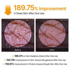 FLEXQW Kojic Acid Turmeric Exfoliating Body Scrub Spray for Smooth Skin