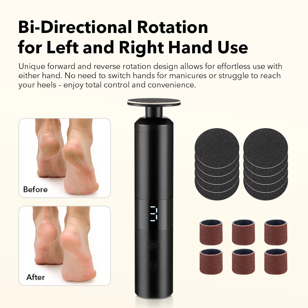 Electric Foot Callus Remover and Pedicure Tool - 2