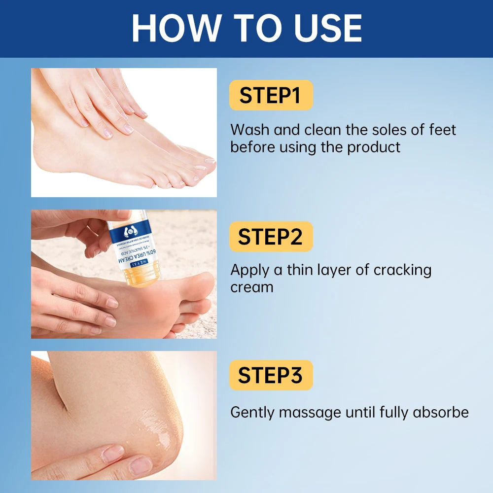 Heyxi 60 Percent Urea Cream Moisturizing Hand and Foot Repair Balm