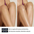 Glycolic Acid Exfoliating Body Stick for Smooth Skin
