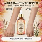 Herbal Cyperus Oil Hair Growth Inhibitor and Soothing Serum