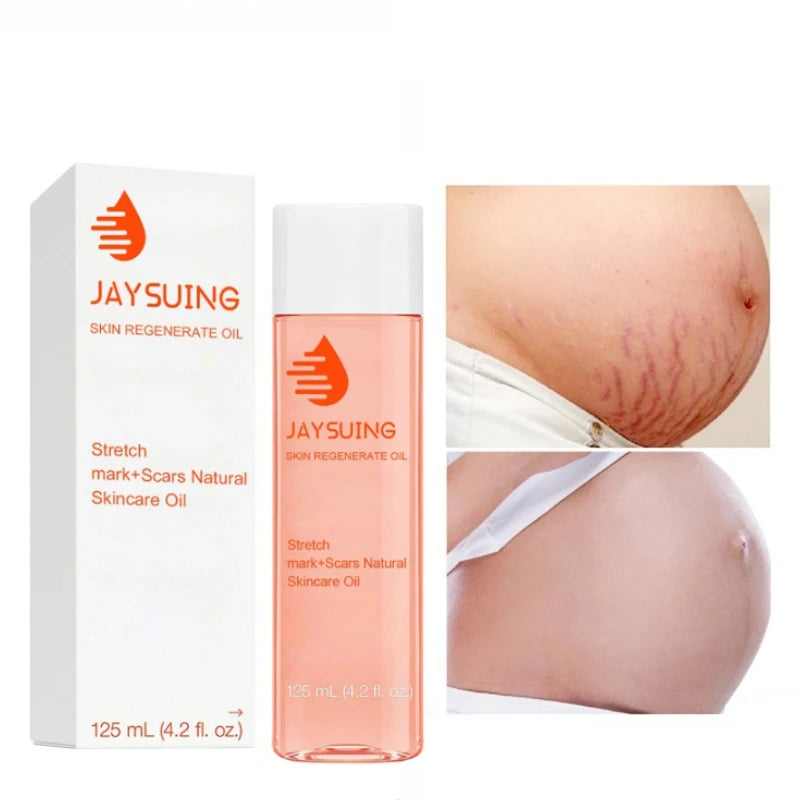 Mango Stretch Mark Cream and Repair Oil for Maternity Skin Care