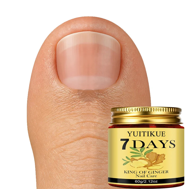 YUITIKUE Ginger Nail Repair Cream 60g Cuticle Nourishing Treatment - 2
