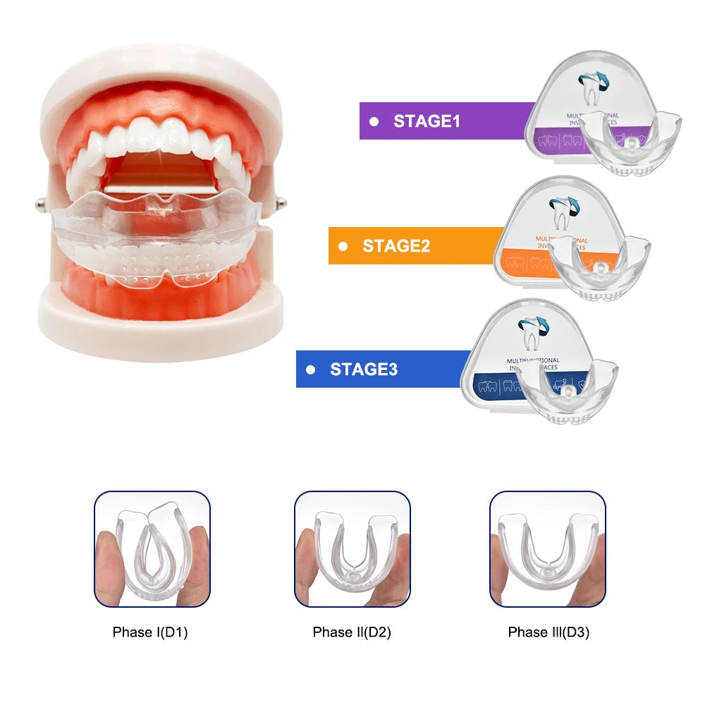 3-Stage Adult Teeth Straightening Alignment Trainer Mouthpiece - 1