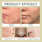 West Month Glycolic Acid 7 Percent Toning Solution Exfoliating Toner