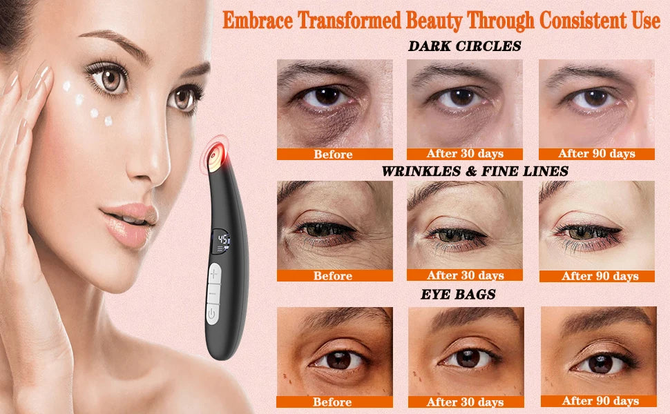 3-in-1 Heated Eye and Face Rejuvenation Massaging Wand