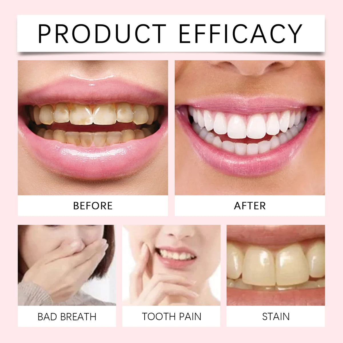 Teeth Whitening and Cavity Repair Toothpaste
