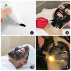 Carbon Laser Facial Gel for Skin Rejuvenation and Deep Pore Cleansing