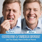 Comfort Fit Silicone Denture Set for Instant Smile Confidence