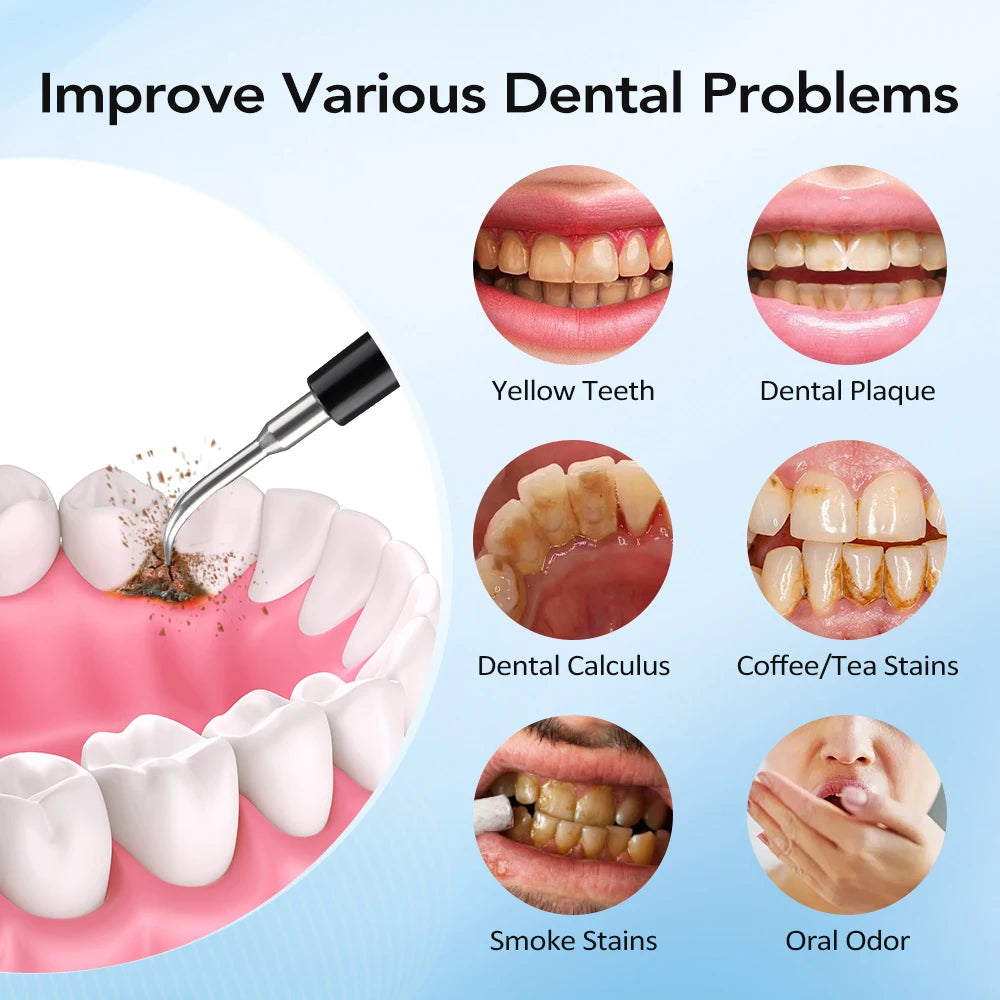 Electric Sonic Teeth Whitening and Plaque Removal Kit - 11