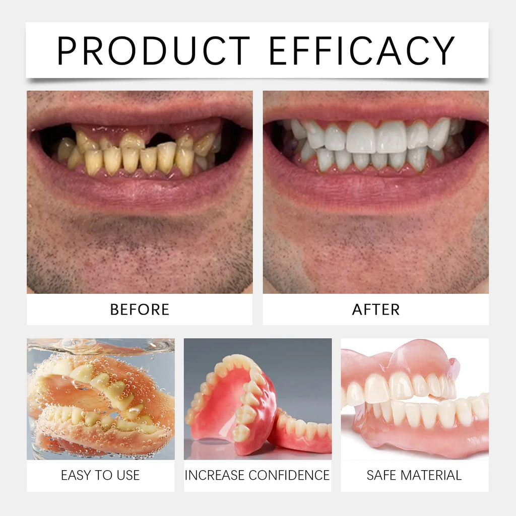 Temporary Silicone Denture Kit for Smile Restoration