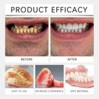 Temporary Silicone Denture Kit for Smile Restoration