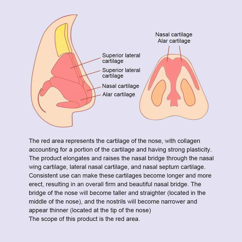 EMS Electric Nose Lifting and Shaping Massager - 10