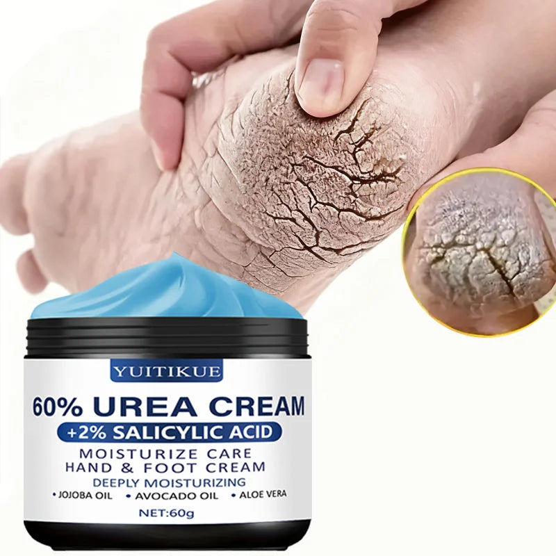 YUITIKUE 60% Urea Foot Cream Moisturizer for Dry Cracked Heels and Skin - 3