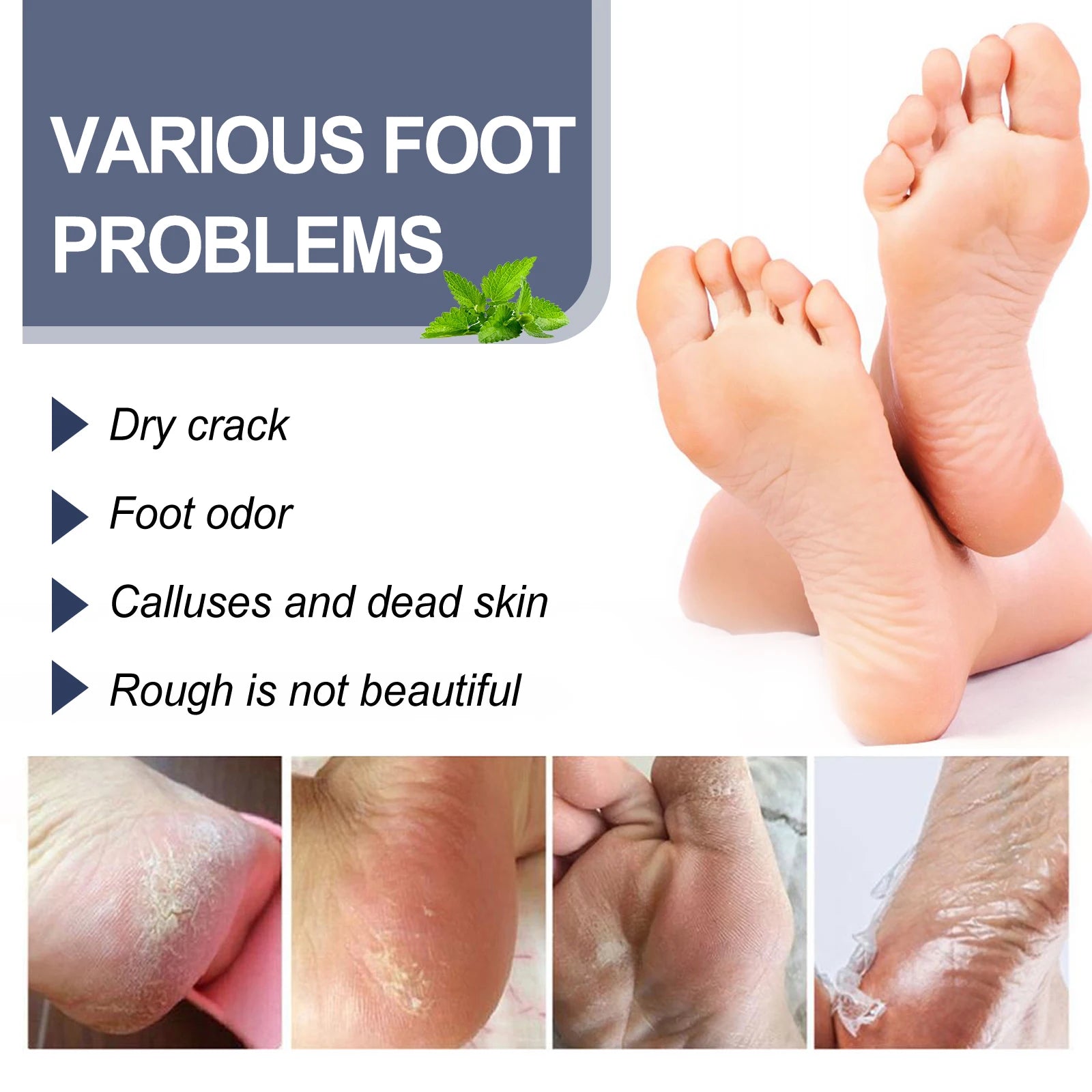 Refreshing Foot Deodorizer and Moisturizing Spray - 8