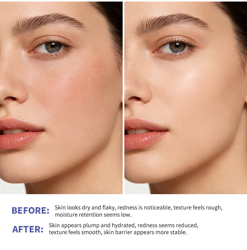 Triple Lipid Peptide Moisturizing Face Cream for Dry Sensitive Skin