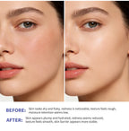 Triple Lipid Peptide Moisturizing Face Cream for Dry Sensitive Skin