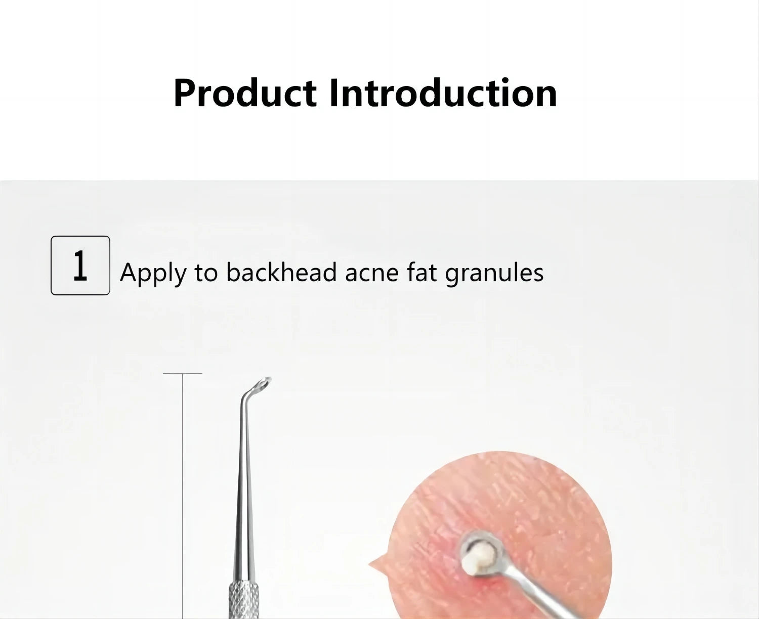 Professional Stainless Steel Blackhead and Pimple Extractor Tool Kit - 11