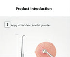 Professional Stainless Steel Blackhead and Pimple Extractor Tool Kit