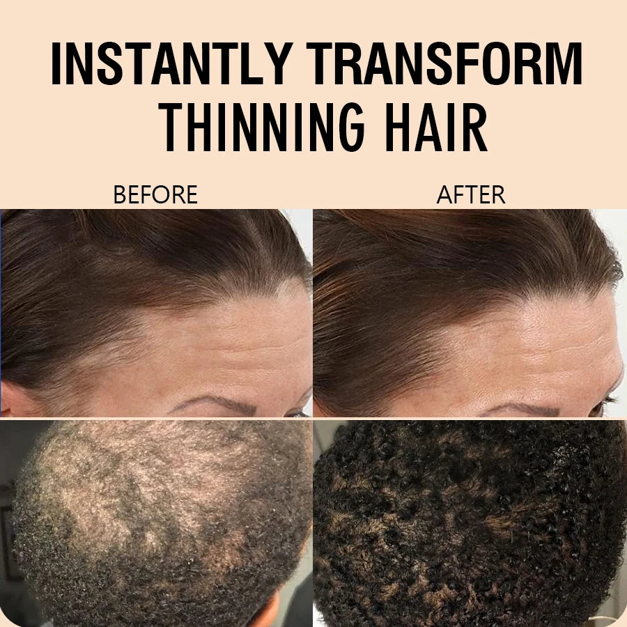 15g Hair Building Fiber Powder Set with Applicator and Hairline Tool - 5