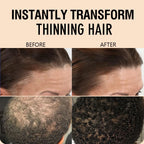 15g Hair Building Fiber Powder Set with Applicator and Hairline Tool