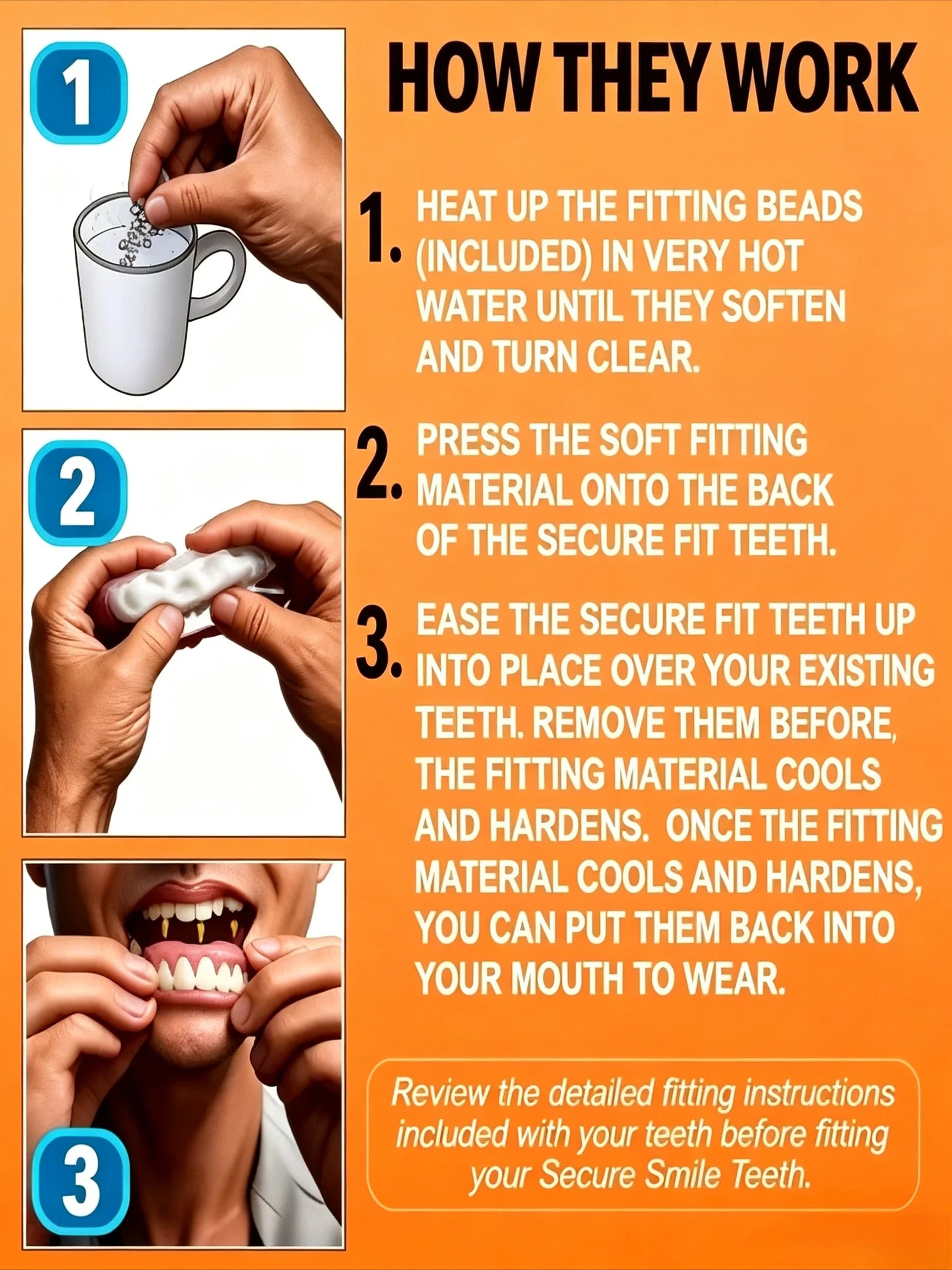 Cosmetic Smile Veneers for Upper and Lower Teeth - 11